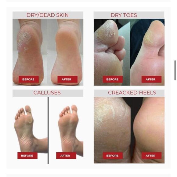 🌟EXFOLIATING Foot Peel Mask For Softer, Smooth Feet- Gently Skin (2 Pack)🌟 - Picture 3 of 6